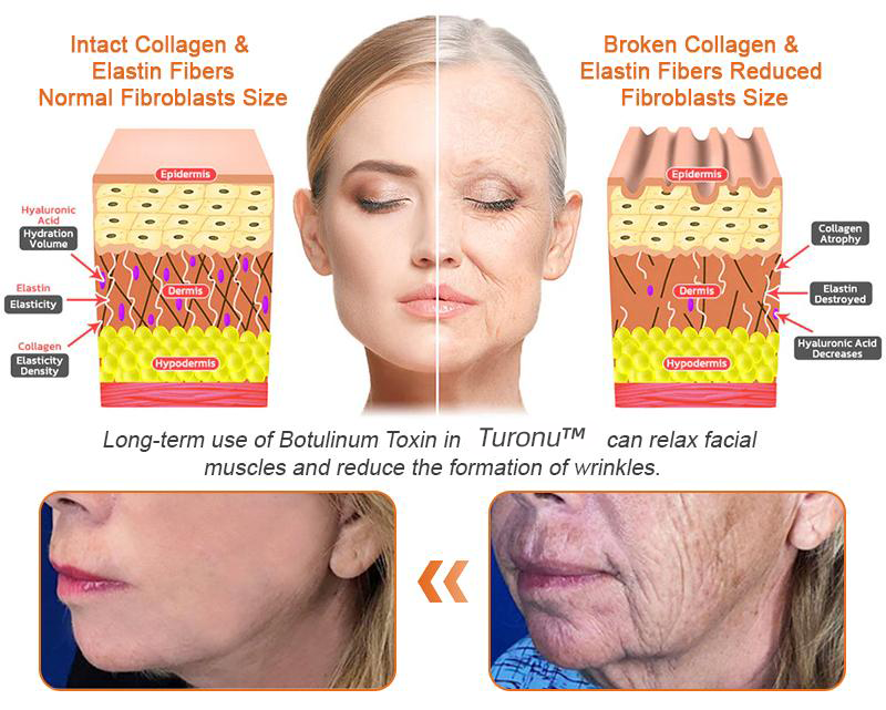 TLOPA® Botox Bee Venom Firming Serum Stick 38 9 8cdaf959 d9bf 4b0e ad25 11641c3dead9